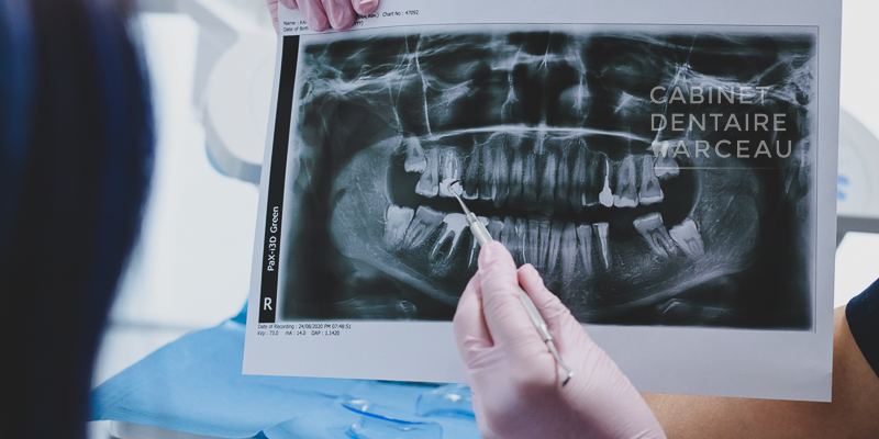 Radiologie dentaire - Cabinet Dentaire Marceau à Montreuil